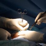 SCS copyright sustainable children surgery 8632